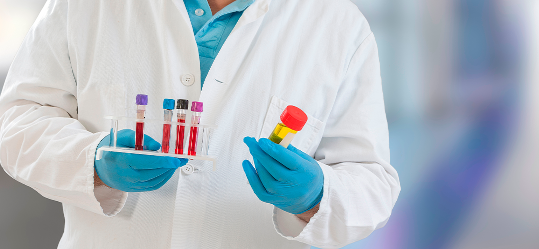 Testes de função renal para diagnosticar doenças renais