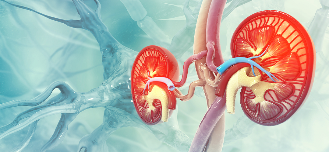 8 fatores de risco para câncer de rim
