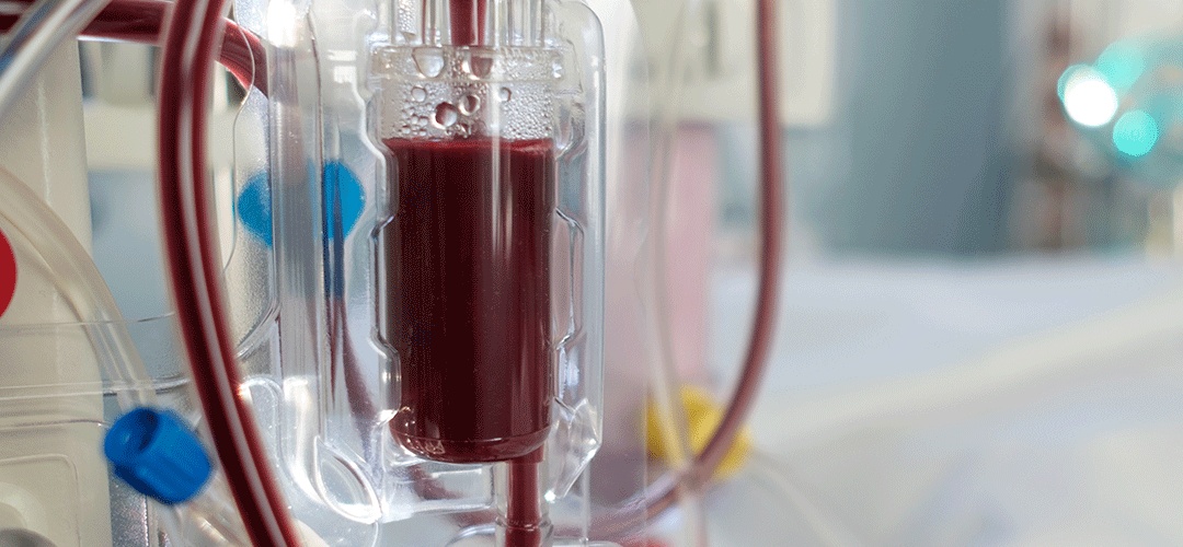 Doenças renais raras: os desafios do tratamento