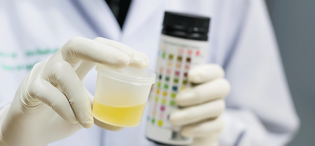 qual exame detecta insuficiência renal