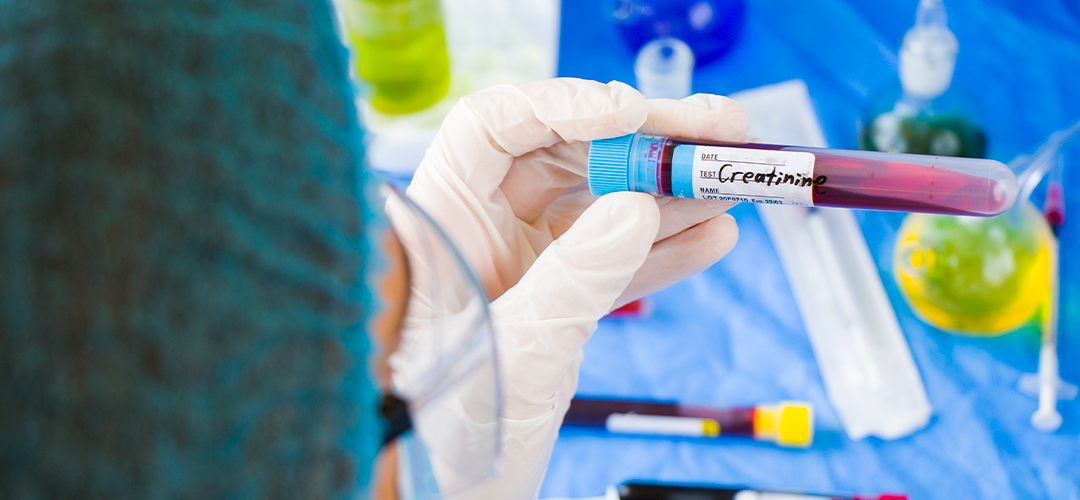 Ureia e creatinina altas são prejudiciais para os rins?