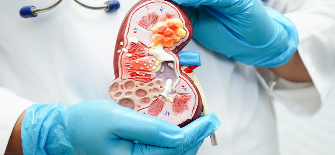 Tratamento interdisciplinar para doenças renais crônicas